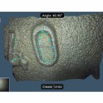 Videoendoscop Mitcorp X3000HD cu masurare 3D